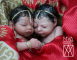 Silicone Premature HINDU Twins 