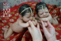 Silicone Premature HINDU Twins 